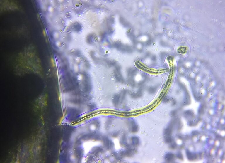 Microscope, Green Algae, Saint Michel District (Bordeaux) strain, by Green Riot 2017