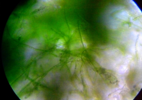 Microscope, Green Algae, Saint Eloi District (Bordeaux) strain, by Green Riot 2011