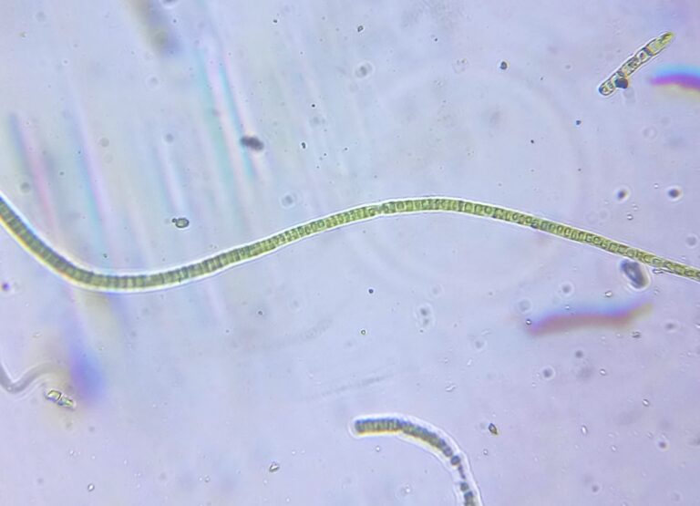 Microscope, Green Algae, Saint Michel District (Bordeaux) strain, by Green Riot 2017