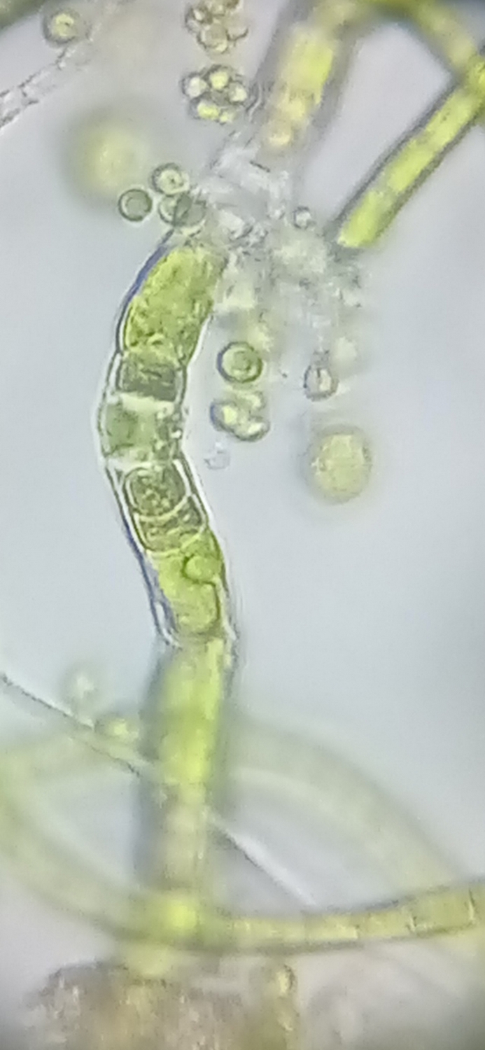 Microscope Green Algae, Saint Pierre District (Bordeaux) strain, by Green Riot 2022