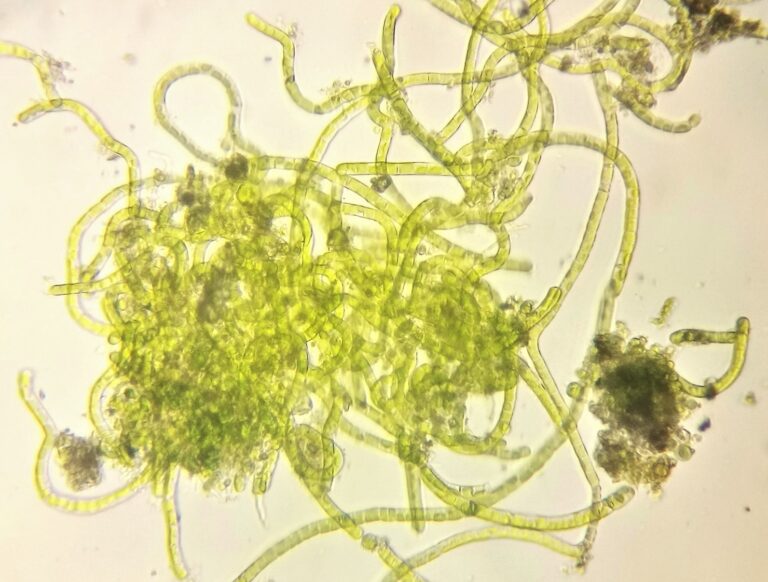 Microscope, Green Algae, Saint Michel District (Bordeaux) strain, by Green Riot 2018