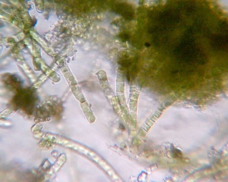 Microscope, Green Algae, Saint Michel District (Bordeaux) strain, by Green Riot 2008
