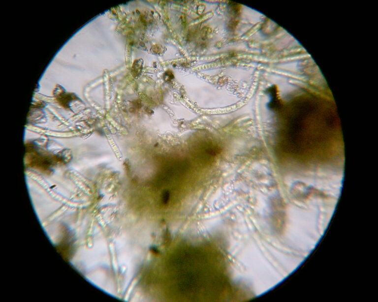 Microscope, Green Algae, Saint Michel District (Bordeaux) strain, by Green Riot 2008
